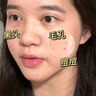 儒意（RUYI）水楊酸面膜20片祛痘淡痘印果酸控油清潔收縮毛孔女男士補(bǔ)水青少年 曬單實(shí)拍圖