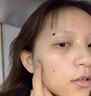 DR.CFUN德國醫(yī)用級點痣祛去痣點痣膏官方正品無痕臉部黑痣雀斑點痣疣藥水 【德國專研】醫(yī)用級點痣 | 適用于各種痣痦 曬單實拍圖