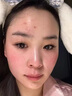 焦博士日本曬后修復面膜修復敏感皮膚屏障受損泛紅醫(yī)美用防曬傷急救白 曬單實拍圖