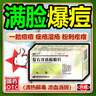 祛痘去痘痘消炎痤瘡專用閉口粉刺復(fù)方珍珠暗瘡片青春痘祛痘痤瘡專用藥臉上去痘痘的藥清熱解毒下巴紅腫硬痘痘 三盒裝【滿臉青春痘 消痘祛痘】 國藥準(zhǔn)字OTC 內(nèi)調(diào)消痘中成藥 曬單實(shí)拍圖