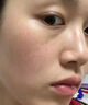 喬記本草雀斑祛除專用美白祛斑霜點(diǎn)斑藥水去黃褐老年斑去黑色素一夜消進(jìn)口 1盒【雀斑祛除專用霜】多買多送 377美白祛斑霜去斑黃褐雀斑曬斑 曬單實(shí)拍圖