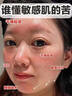 鑫博士377面膜美白補(bǔ)水淡斑提亮膚色女抗皺緊致抗衰老收縮毛孔祛黃面膜 2盒 20片 【輕微斑點(diǎn)】 曬單實(shí)拍圖