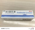 麗芙維a酸乳膏0.025%*10g維A酸軟膏祛痘印修復(fù)淡化痘印痘坑修復(fù)祛痘藥膏凝膠祛斑改善黑色素雞皮膚去黑頭 曬單實拍圖