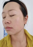 疣瘊靈去i除脖子小肉粒扁平疣專用膏藥去i疣體100%膏藥進口絲狀疣 買2送1【周期特效裝】 曬單實拍圖