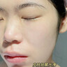焦博士日本曬后修復(fù)面膜修復(fù)敏感皮膚屏障受損泛紅醫(yī)美用防曬傷急救白 曬單實(shí)拍圖