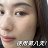 百靈鳥377美白祛斑霜祛斑美白淡化黑色素去雀斑老年黃褐斑男女士專用 曬單實(shí)拍圖