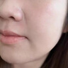 維特絲祛痘藥膏50g壬二酸水楊酸去痘痘和收毛孔閉口粉刺男女精華 曬單實拍圖