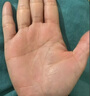 頤博士維e尿素霜止身上癢軟膏ve皮膚瘙癢干燥掉皮身上大腿內側癢 1支[體驗裝]無(wú)滿(mǎn)送 曬單實(shí)拍圖
