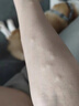 時珍星脂肪瘤專用膏專消皮下多發(fā)性脂肪瘤粒藥監(jiān)備案去除囊腫硬包塊 曬單實拍圖
