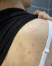 CERTAIN DRI雞皮膚去除神器去雞皮膚毛囊角質(zhì)疙瘩大腿毛囊角化癥專(zhuān)用特效的藥 【2盒裝】中度雞皮毛囊（80%選擇 曬單實(shí)拍圖