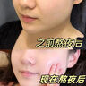 韓方五谷黃芪水乳液面霜補(bǔ)水保濕美白去黃提亮抗皺緊致男女護(hù)膚品100ml 曬單實(shí)拍圖