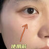 Losoki瑞士進(jìn)口眼霜淡化細(xì)紋提拉緊致黑眼圈去眼袋抗皺抗衰老護(hù)膚品禮物 曬單實拍圖