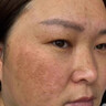珀美博士 DR.BORMELL陽陽美白祛斑霜去斑黃褐斑雀斑曬斑專用淡化色斑黑色素老年斑可用 1瓶 曬單實拍圖