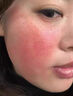 VERZXMERY 御宅鮮顏重組膠原蛋白冷敷貼面膜術(shù)后曬后敏感肌修護肌膚祛紅腫去痘痘肌女 御宅鮮顏重組膠原蛋白敷料 三盒15片 曬單實(shí)拍圖