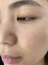 收縮毛孔粗大修復(fù)細(xì)致醫(yī)用阿達(dá)帕林凝膠改善毛孔粗大醫(yī)用去黑頭祛痘消炎痤瘡專用青少年藥膏修復(fù)痘坑痘印 1盒【毛孔粗大藥膏】醫(yī)用級 藥房直發(fā) 曬單實拍圖