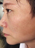 巖井昃弘祛斑點斑專用水藥去斑霜強效第1名臉部手背醫(yī)用正品老年斑一夜消 一盒裝 祛斑美白淡化黃褐雀斑黑色素男士 曬單實拍圖