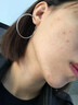 南京同仁堂祛痘膏去痘痘和痘印痘坑修復(fù)男女士改善粉刺閉口30g 曬單實拍圖