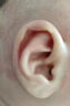 耳廓矯正器嬰兒新生兒招風(fēng)耳廓矯正器寶寶耳朵定型矯正器硅膠耳夾耳廓貼醫用級矯正器 【耳夾-單個(gè)】適用于貼單耳畸形--送固定水凝膠貼 曬單實(shí)拍圖
