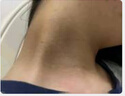巖井昃弘脖子黑色素沉淀去除治黑棘皮癥藥膏男女胖胳膊肘腋下去黑色素神器 特效1瓶【全身黑色素去除】 曬單實(shí)拍圖
