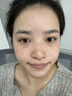 郝愛妮美白祛斑霜淡化黑色素去雀斑黃褐斑祛斑美白提亮去黃改善暗沉膚色 曬單實(shí)拍圖