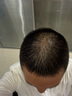 NUTRAFOL聯(lián)合利華NF黃金膠囊男士膠囊生物素防脫養(yǎng)發(fā)內(nèi)服*120粒/瓶 曬單實(shí)拍圖