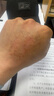 御傳堂濕疹膏成人大腿根內側潮濕瘙癢襠部止癢皮膚陰囊股癬專(zhuān)用 本草新芙8 曬單實(shí)拍圖