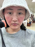 MOIHANR德國面膜醫(yī)用械字號冷敷貼醫(yī)美術后修復保濕補水曬后修復敏感皮膚 【術后修復補水】三盒裝 曬單實拍圖