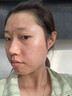 南京同仁堂祛痘膏去痘痘和痘印痘坑修復(fù)男女士改善粉刺閉口30g 曬單實(shí)拍圖
