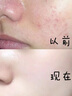 POP POPULAR【官方正品】泰國原裝進(jìn)口護(hù)膚套裝補(bǔ)水保濕去油細(xì)膩肌膚油痘肌 凈顏清爽清肌潤澤5件套/送小雪1 洗面奶+柔膚水+乳液+面霜+面霜*1 曬單實(shí)拍圖