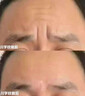 第三代優(yōu)仙眼部抗衰大師面部儀器去眼袋淡化細(xì)紋黑眼圈美容院專用 三代眼部大師 曬單實(shí)拍圖