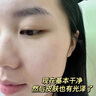焦博士日本熊果苷乳膏煙酰胺凝膠377美白祛斑霜祛斑美白淡化黑色素面霜 曬單實(shí)拍圖