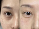儒意（RUYI）淡紋眼霜30g淡化細(xì)紋眼紋抗皺提拉緊致黑眼圈祛護(hù)膚品眼袋衰老 曬單實(shí)拍圖