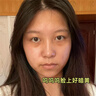 維特絲（vetes）去角質(zhì)面部啫喱控油保濕洗面奶男女士清潔毛孔黑頭閉口溫沒(méi)激素和 【6大專(zhuān)利】果酸去角質(zhì)啫喱200g 曬單實(shí)拍圖