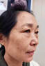 內(nèi)廷上用老年斑臉部手背祛斑專用霜去老人斑的藥強(qiáng)力祛除手部臉部日本進(jìn)口 1盒裝【醫(yī)用祛斑膏】多盒更劃算 男女士美白淡化老年黃褐雀斑黑色素點(diǎn)痣膏 曬單實(shí)拍圖