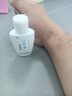 二月白祛痘精華液淡化痘印痘坑去黑頭閉口粉刺露收縮毛孔男女學(xué)生護(hù)膚品 二月白祛痘精華液直營(yíng)店30ml 曬單實(shí)拍圖