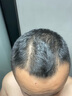 儒意（RUYI）育頭發(fā)液固發(fā)脂溢防脫育發(fā)營(yíng)養增長(cháng)液發(fā)際線(xiàn)生長(cháng)液長(cháng)發(fā)劑頭皮精華 【醫研配方】防脫育發(fā) 100ml*1瓶 曬單實(shí)拍圖