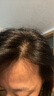 官方授權(quán)】達(dá)霏欣米諾地爾搽劑 男女脫發(fā)禿發(fā)斑禿掉發(fā)拯救發(fā)際線生發(fā)液酊防脫密發(fā) 60ml*1盒【男款，送雙重好禮】咨詢客服領(lǐng)券優(yōu)惠 曬單實(shí)拍圖