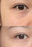 脂肪粒去除藥膏眼周專用去除小顆粒汗管瘤脂肪油脂粒粟丘疹眼霜膏 買2贈1【快速趕走脂肪?！?曬單實拍圖