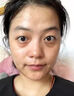 秋雅奈緒黑眼圈重度去除男女士淡化細(xì)紋黑色素眼袋霜提拉緊致專用熬夜神器 一盒體驗(yàn)裝【輕度黑眼圈】 日本進(jìn)口眼霜祛眼袋黑眼圈 曬單實(shí)拍圖
