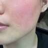 Andwarm原裝進口曬后修復凝膠女男士兒童面部肌膚膏臉曬傷修復補水蘆薈膠 100ml【緊急舒緩修護】 曬單實拍圖