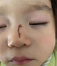 御夫清美國進口疤克巴克祛疤膏兒童去疤痕修復凝膠小孩專用除去疤膏手術 曬單實拍圖