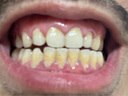 高露潔（Colgate）【孫穎莎同款】速感白美白牙膏亮白去黃去煙漬85g 新老包裝隨機 曬單實拍圖