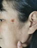 巖井昃弘祛斑點(diǎn)斑專用水藥去斑霜強(qiáng)效第1名臉部手背醫(yī)用正品老年斑曬斑女 一盒裝【日本進(jìn)口】 祛斑美白淡化黃褐雀斑黑色素男士 曬單實(shí)拍圖