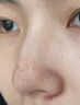 維特絲去黑頭鼻貼10組20片免撕拉面膜導出液收縮毛孔清潔粉刺神器男女士 曬單實拍圖