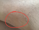 百靜康吳竹百靜康草本抑菌乳膏百康靜皮膚瘙癢手腳大腿內側肛門(mén)陰囊jy11 三盒乳膏 曬單實(shí)拍圖