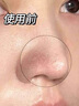 OHBT紫蘇果酸清潔泥膜150g面膜深層清潔去黑頭收縮毛孔祛痘金榜第1名 曬單實(shí)拍圖