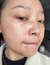 南京同仁堂祛痘膏去痘痘和痘印痘坑修復男女士改善粉刺閉口30g 曬單實拍圖