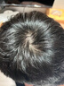 同仁堂【發(fā)量翻倍漲】育發(fā)液防脫發(fā)育發(fā)濃密增長(cháng)液頭發(fā)生長(cháng)激活毛囊增發(fā) 第2瓶半價(jià)【輕度脫發(fā)】激活毛囊 曬單實(shí)拍圖