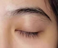 H18日本顆粒清肌眼霜脂肪粒去除眼部專用非藥膏汗管去除藥膏男女專用 曬單實拍圖