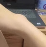 霍悉醫(yī)生腱鞘炎手腕腱鞘炎凝膠手指大拇指鼠標(biāo)囊腫鼓包網(wǎng)球肘專用非膏藥貼 曬單實拍圖